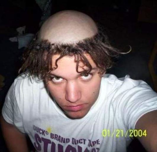 まだ行ける 薄毛の人のためのヘアスタイル 面白画像 Ailovei