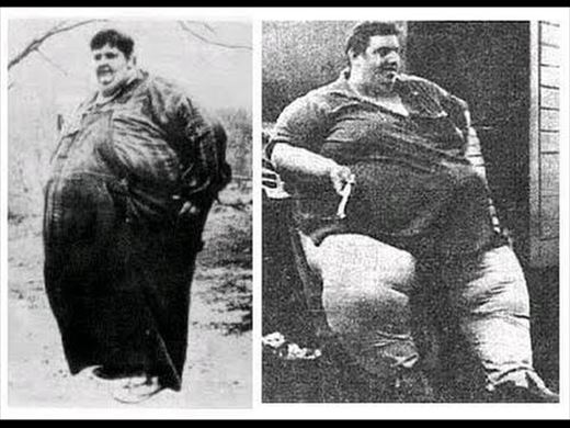 史上最も太っていた人（体重の重さランキング&彼らの半生）