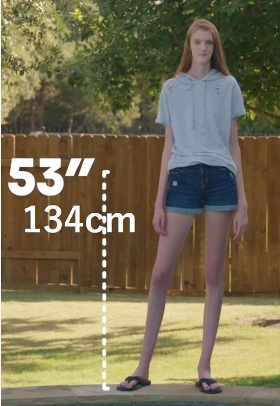 0cm超え 背が高すぎる女性たち 世界一 Ailovei
